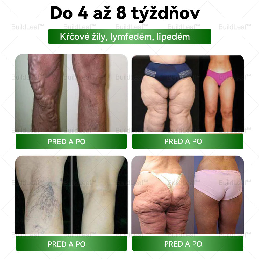 BuildLeaf® 🎁🎁 Posledná šanca! Získajte tento šťastný nález so 🎉50% zľavou!