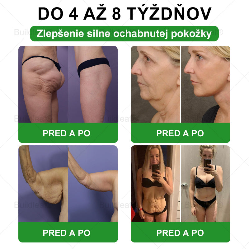 BuildLeaf® 🎁🎁 Posledná šanca! Získajte tento šťastný nález so 🎉50% zľavou!
