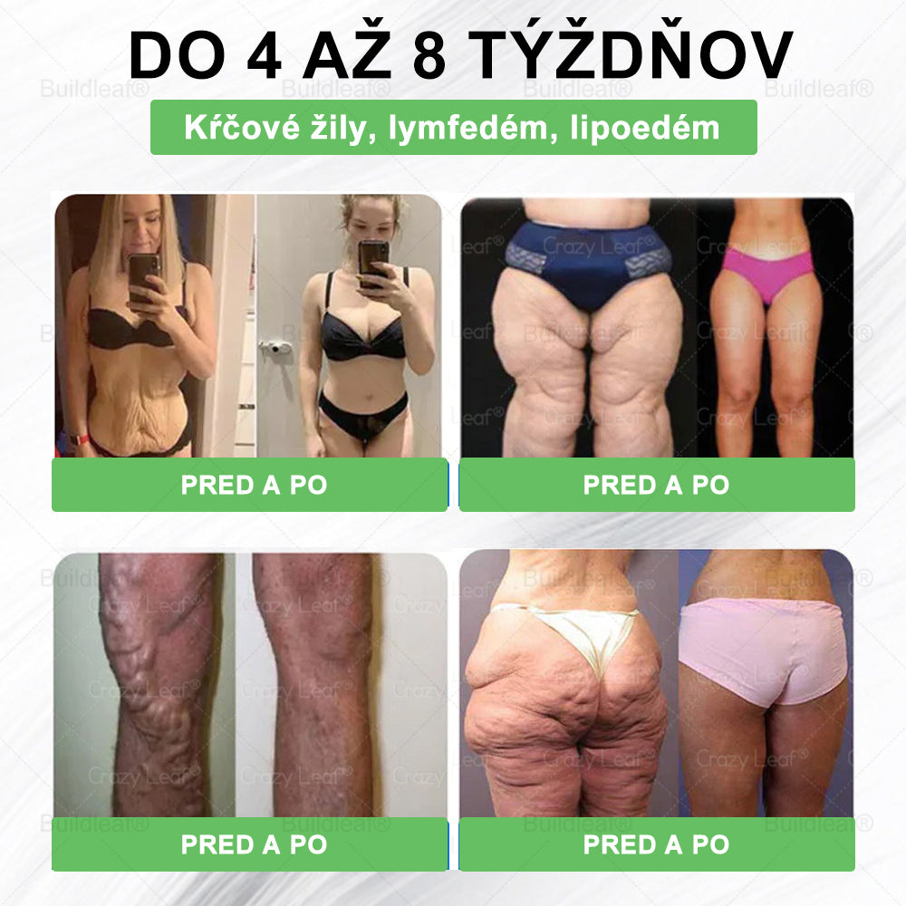 BuildLeaf® 🎁🎁 Posledná šanca! Získajte tento šťastný nález so 🎉50% zľavou!