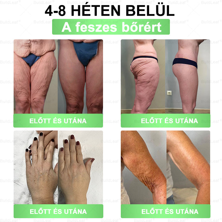 đKorlĂĄtozott kĂ©szlet! A BuildLeafÂź đ tovĂĄbbi 30% kedvezmĂ©nyt kĂnĂĄl! Helyezze vissza testĂ©t Ă©s egĂ©szsĂ©gĂ©t. Cselekedjen most â ez a lehetĆsĂ©g nem tart sokĂĄig.
