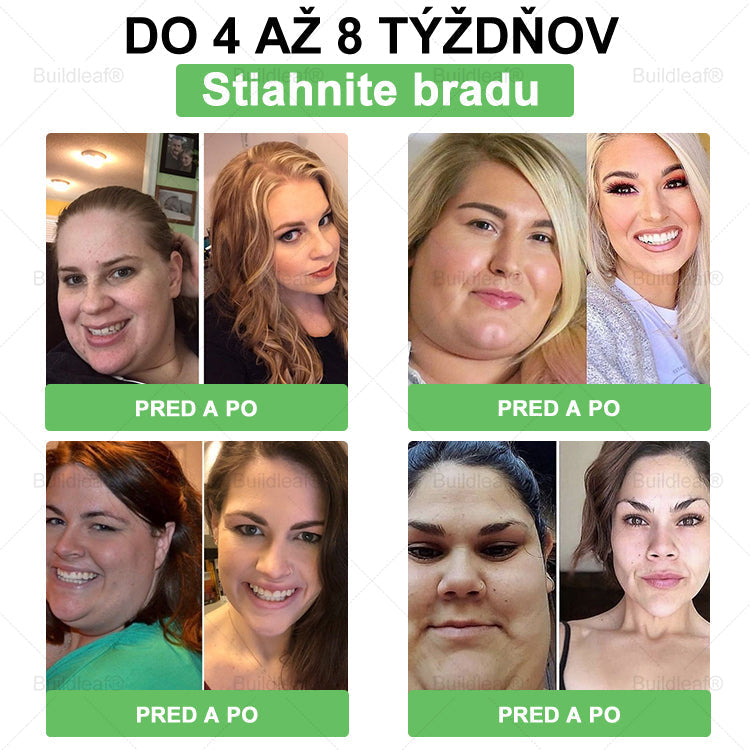 BuildLeaf® 🎁🎁 Posledná šanca! Získajte tento šťastný nález so 🎉50% zľavou!