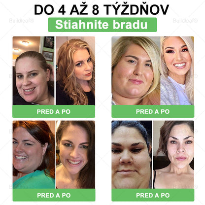 BuildLeaf® 🎁🎁 Posledná šanca! Získajte tento šťastný nález so 🎉50% zľavou!